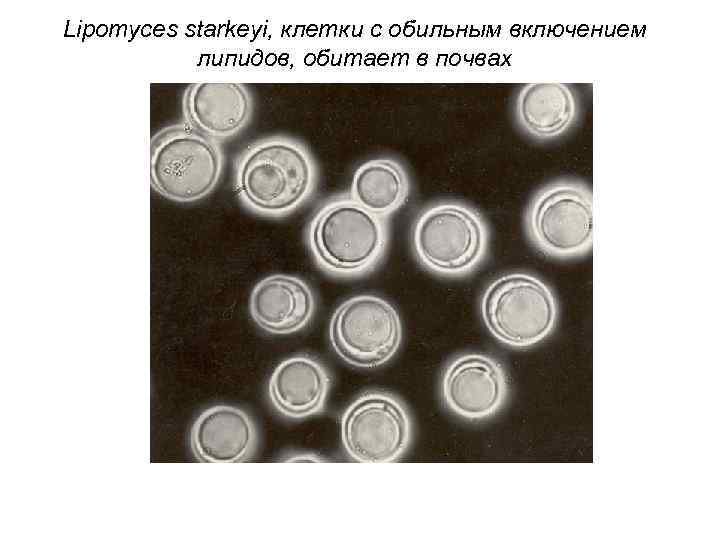 Lipomyces starkeyi, клетки с обильным включением липидов, обитает в почвах 