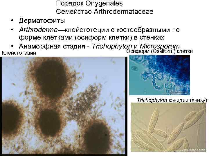 Порядок Onygenales Семейство Arthrodermataceae • Дерматофиты • Arthroderma—клейстотеции c костеобразными по форме клетками (осиформ