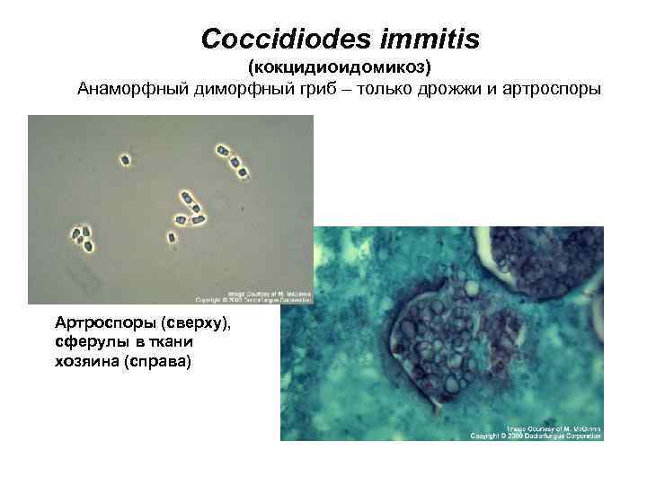 Coccidiodes immitis (кокцидиоидомикоз) Анаморфный диморфный гриб – только дрожжи и артроспоры Артроспоры (сверху), сферулы