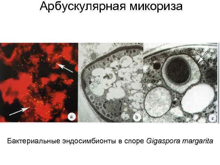 Арбускулярная микориза Бактериальные эндосимбионты в споре Gigaspora margarita 