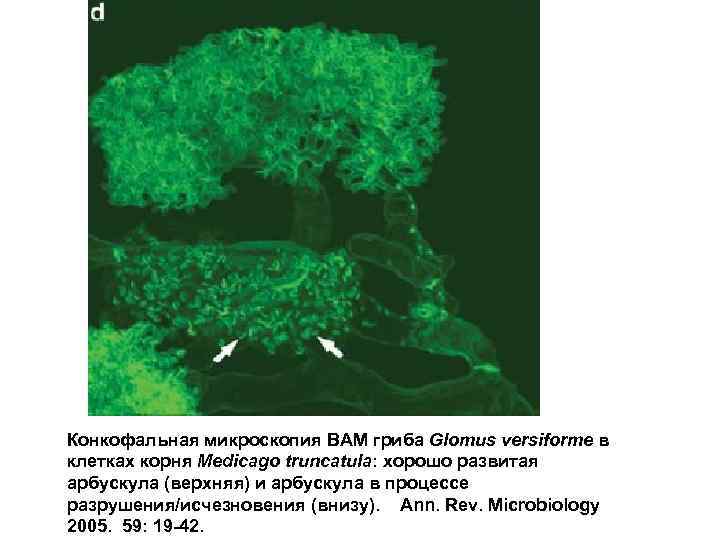 Конкофальная микроскопия ВАМ гриба Glomus versiforme в клетках корня Medicago truncatula: хорошо развитая арбускула