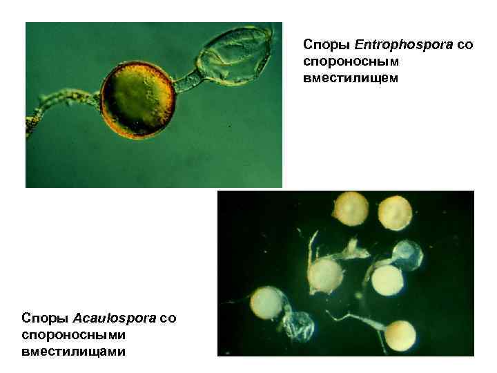 Споры Entrophospora со спороносным вместилищем Споры Acaulospora со спороносными вместилищами 