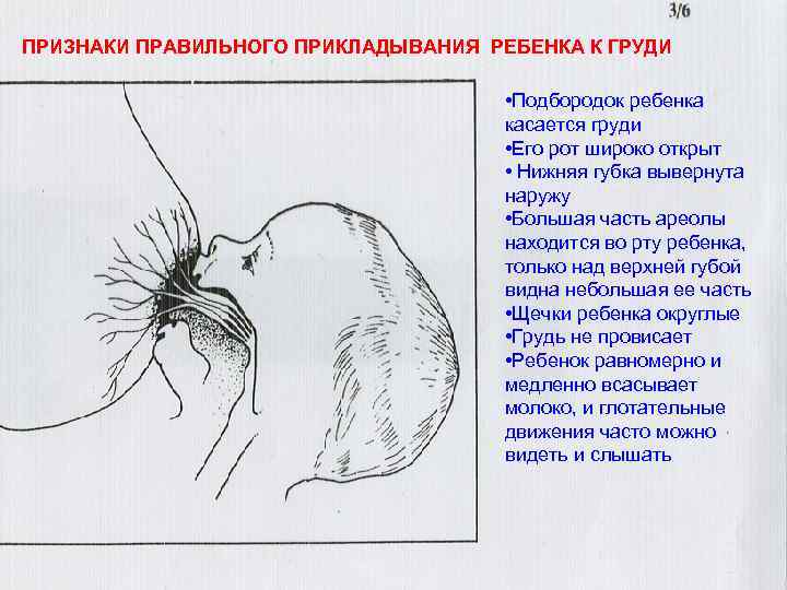 ПРИЗНАКИ ПРАВИЛЬНОГО ПРИКЛАДЫВАНИЯ РЕБЕНКА К ГРУДИ • Подбородок ребенка касается груди • Его рот