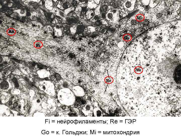 Fi = нейрофиламенты; Re = ГЭР Go = к. Гольджи; Mi = митохондрия 