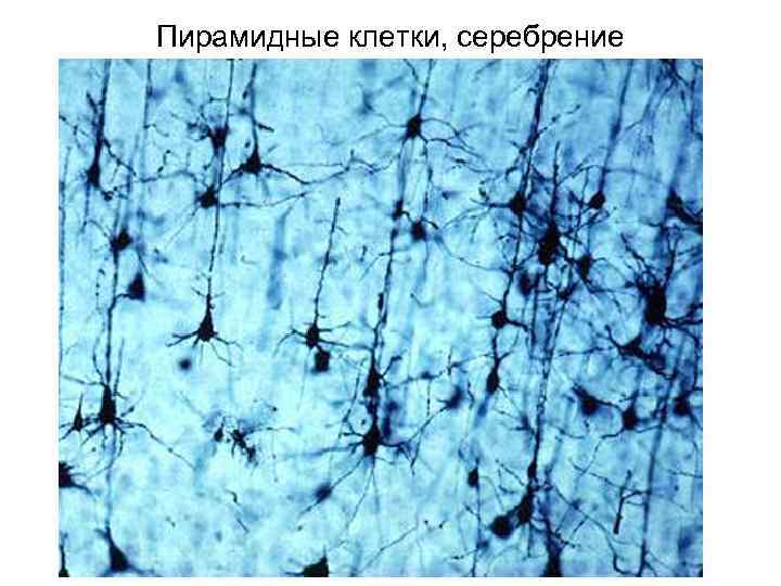 Пирамидные клетки, серебрение 