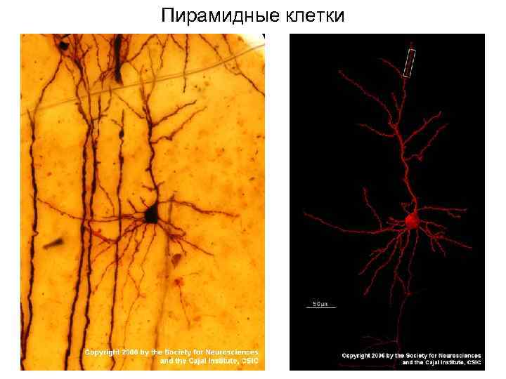 Пирамидные клетки 