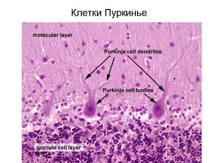 Клетки Пуркинье 