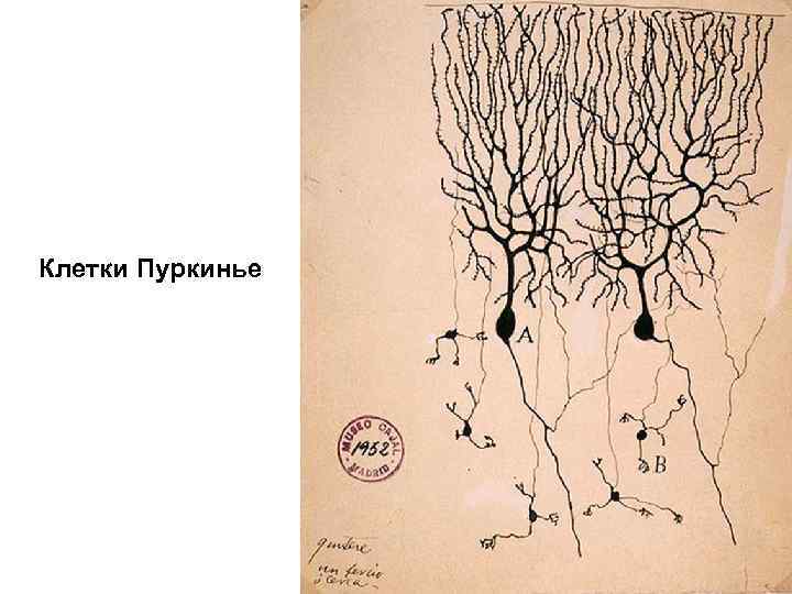 Клетки пуркинье рисунок