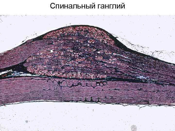 Спинальный ганглий 