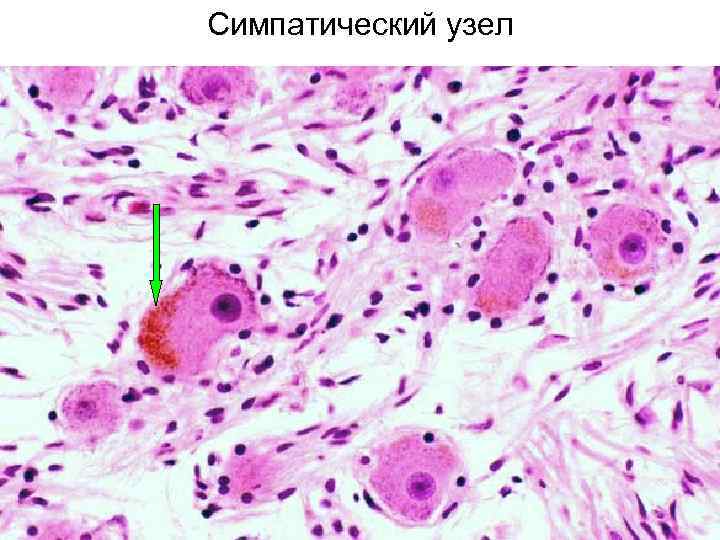 Симпатический узел 