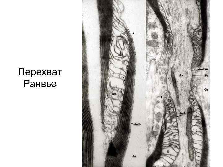 Перехват Ранвье 