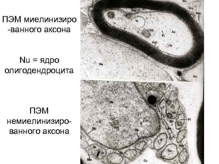 ПЭM миелинизиро -ванного аксона Nu = ядро олигодендроцита ПЭМ немиелинизированного аксона 