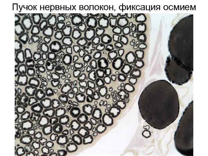 Пучок нервных волокон, фиксация осмием 
