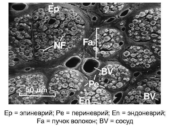Ep = эпиневрий; Pe = периневрий; En = эндоневрий; Fa = пучок волокон; BV