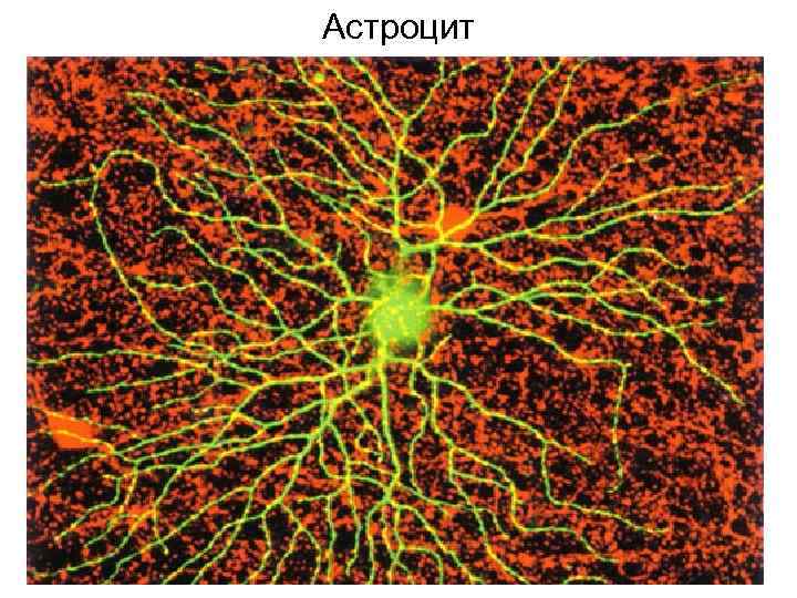 Астроцит 