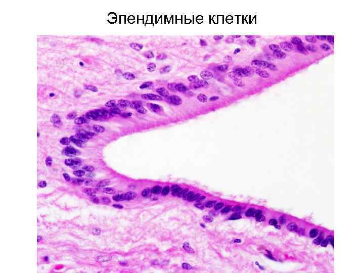 Эпендимные клетки 