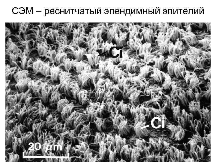 СЭМ – реснитчатый эпендимный эпителий 