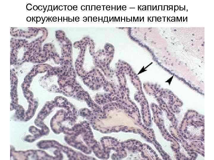Сосудистое сплетение – капилляры, окруженные эпендимными клетками 