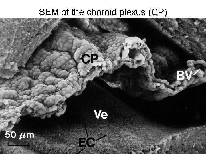 SEM of the choroid plexus (CP) 