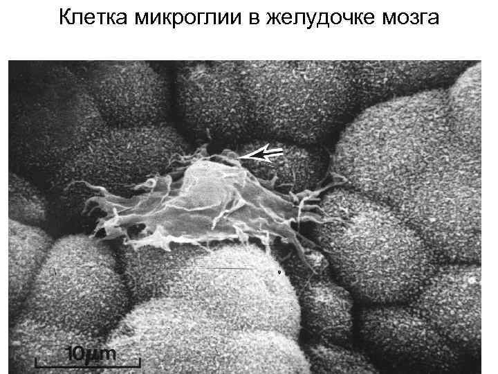 Клетка микроглии в желудочке мозга 