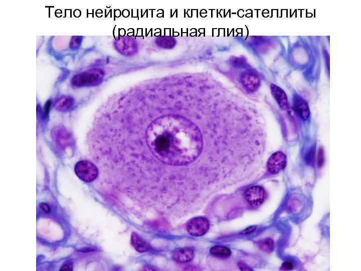 Тело нейроцита и клетки-сателлиты (радиальная глия) 