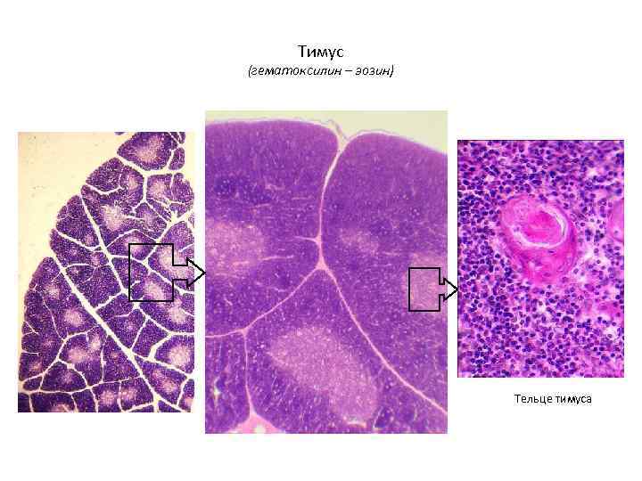 Тимус (гематоксилин – эозин) Тельце тимуса 