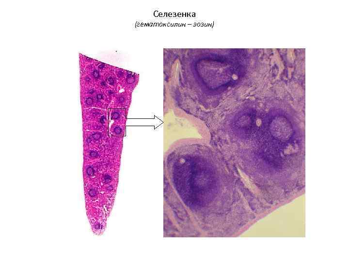 Селезенка (гематоксилин – эозин) 