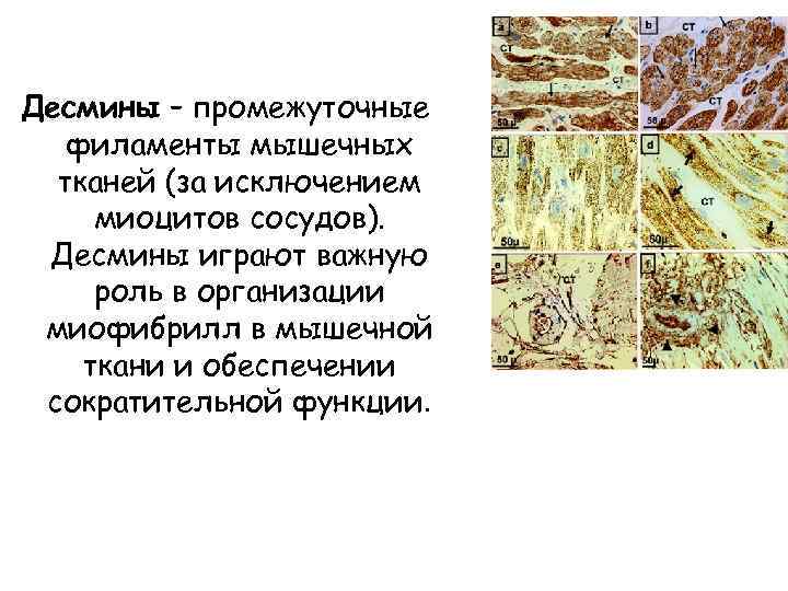 Десмины – промежуточные филаменты мышечных тканей (за исключением миоцитов сосудов). Десмины играют важную роль