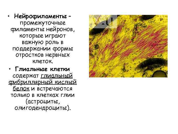  • Нейрофиламенты – промежуточные филаменты нейронов, которые играют важную роль в поддержании формы