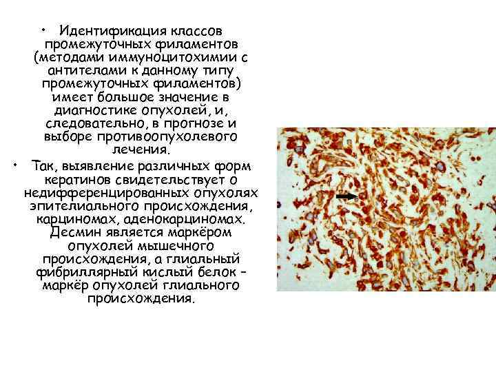  • Идентификация классов промежуточных филаментов (методами иммуноцитохимии с антителами к данному типу промежуточных