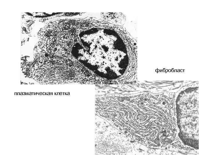 фибробласт плазматическая клетка 