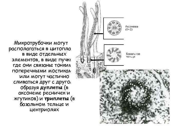 Микротрубочки могут располагаться в цитоплазме в виде отдельных элементов, в виде пучков, где они