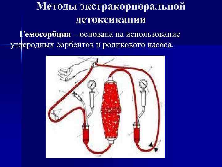 Экстракорпоральные методы детоксикации презентация