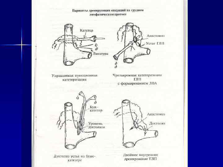     Озонотерапия  В комплексном лечении больных обширными ранами мягких тканей