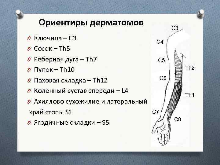 Ориентиры дерматомов O Ключица – С 3 O Сосок – Th 5 O Реберная