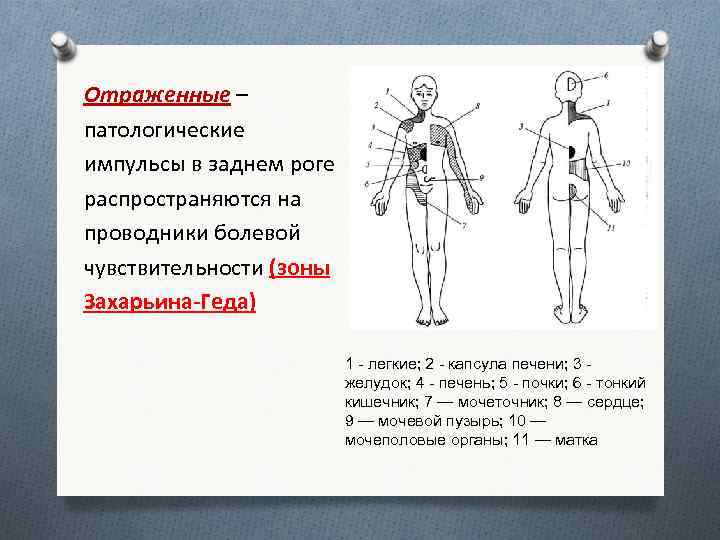 Зоны захарьина геда схема на лице