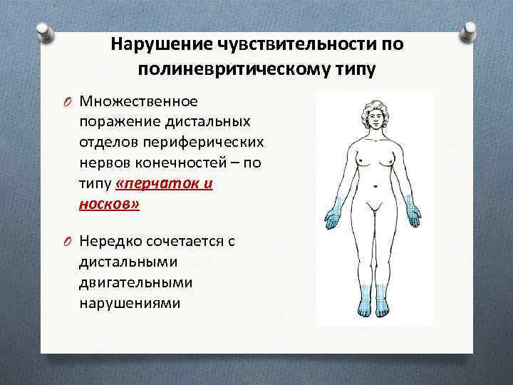 Нарушение чувствительности по полиневритическому типу O Множественное поражение дистальных отделов периферических нервов конечностей –