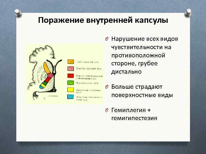 Внутренняя капсула. Симптомы поражения внутренней капсулы головного мозга. Внутренняя капсула неврология строение. Синдром поражения внутренней капсулы головного мозга. Синдром поражения внутренней капсулы неврология.