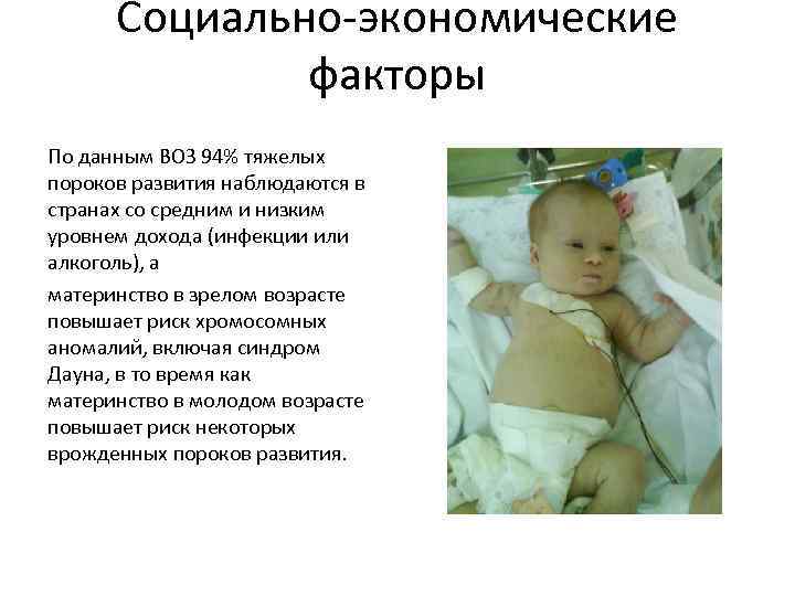 Социально-экономические факторы По данным ВОЗ 94% тяжелых пороков развития наблюдаются в странах со средним