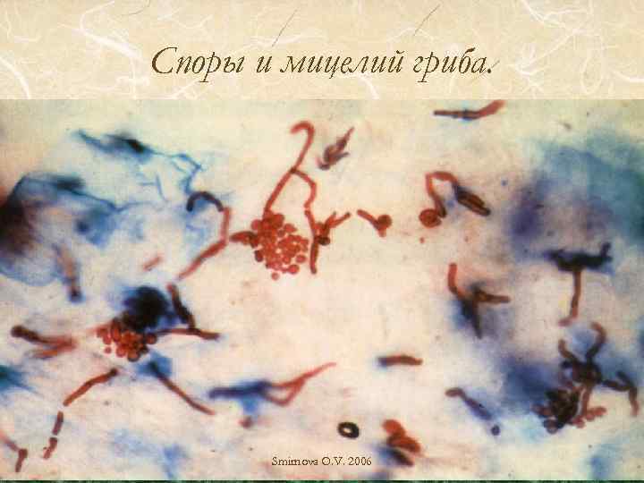 Споры и мицелий гриба. Smirnova O. V. 2006 