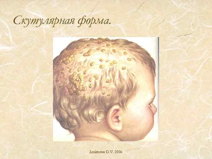 Скутулярная форма. Smirnova O. V. 2006 