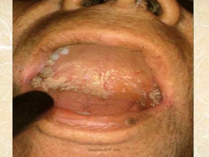 Smirnova O. V. 2006 