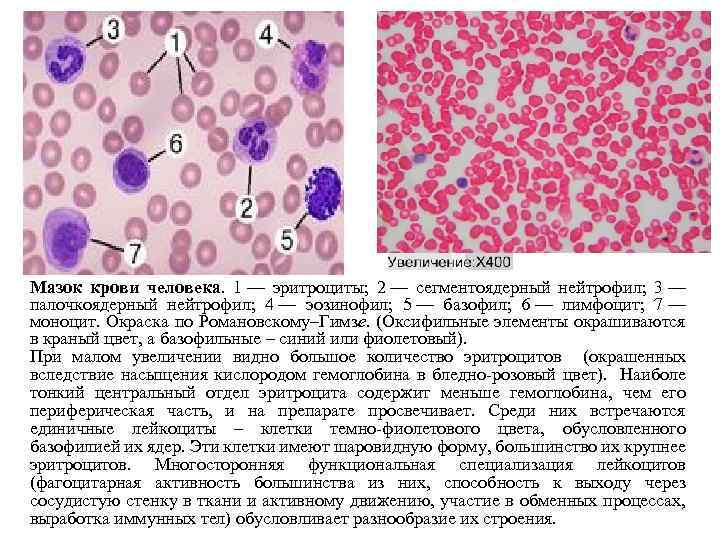 По изображению с микроскопа в препарате угла глаза при малом увеличении видна крупная оксифильная