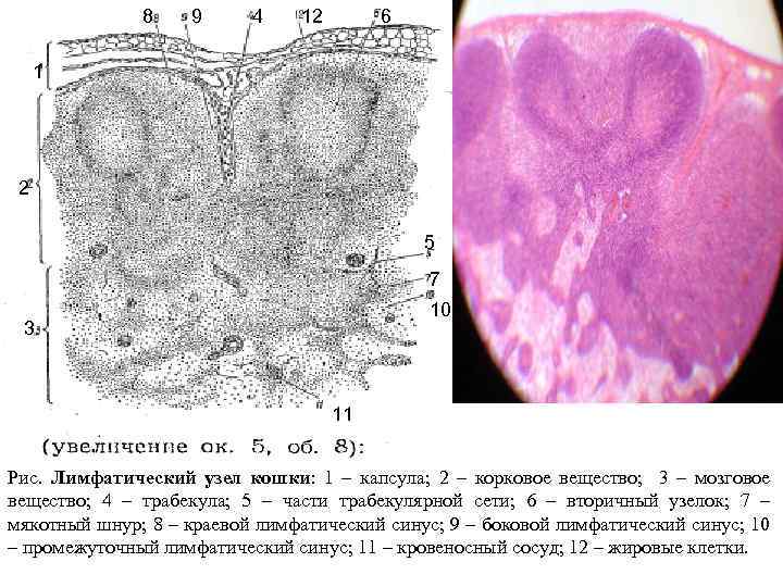 Лимфатический узел гистология схема