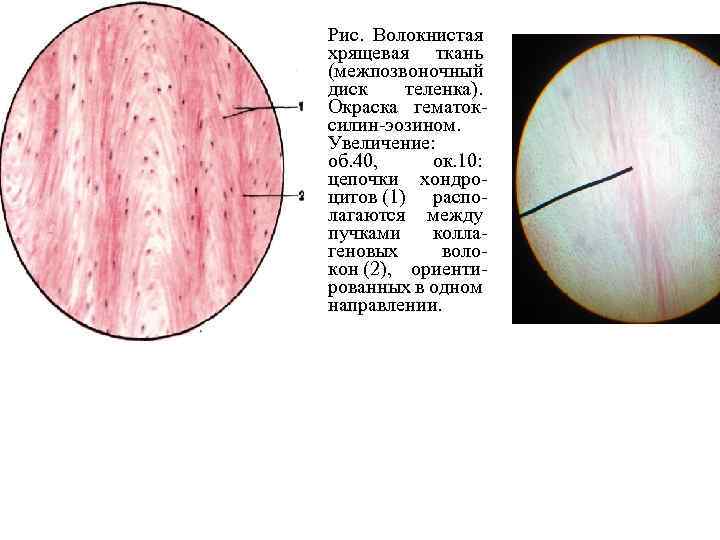 Волокнистый хрящ гистология рисунок