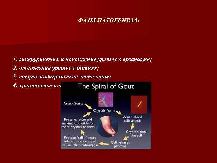 ФАЗЫ ПАТОГЕНЕЗА: 1. гиперурикемия и накопление уратов в организме; 2. отложение уратов в тканях;