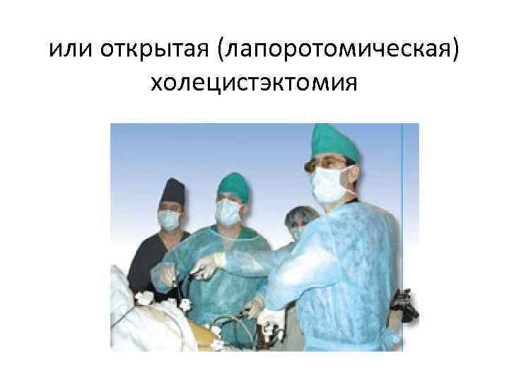 или открытая (лапоротомическая) холецистэктомия 