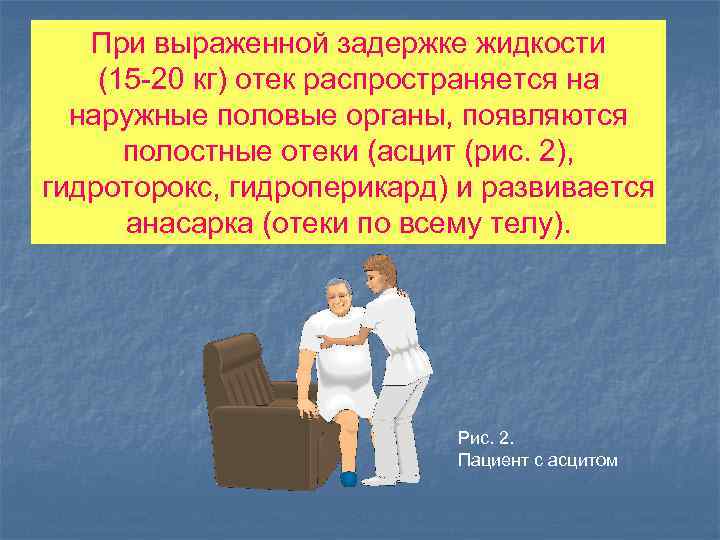 При выраженной задержке жидкости (15 -20 кг) отек распространяется на наружные половые органы, появляются