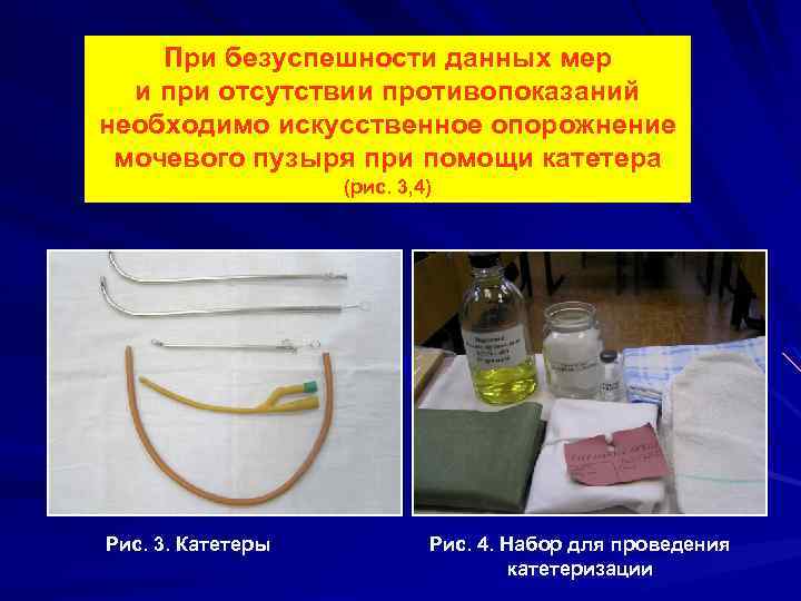 При безуспешности данных мер и при отсутствии противопоказаний необходимо искусственное опорожнение мочевого пузыря при
