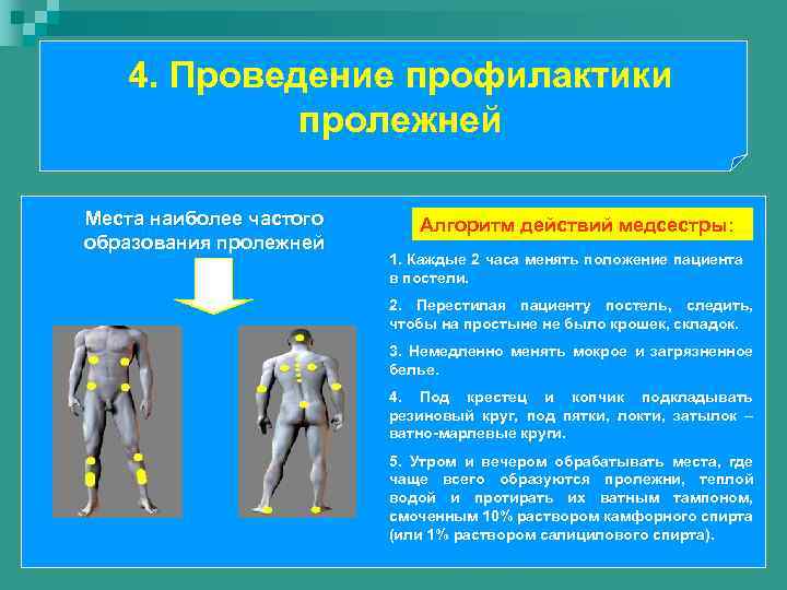 4. Проведение профилактики пролежней Места наиболее частого образования пролежней Алгоритм действий медсестры: 1. Каждые